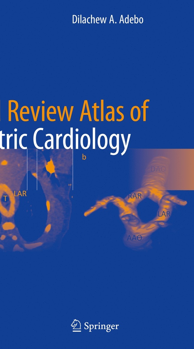 Dilachew A. Adebo - Board Review Atlas of Pediatric Cardiology, Häftad