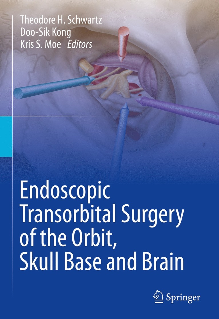 Theodore H. Schwartz, Doo-Sik Kong, Kris S. Moe - Endoscopic Transorbital Surgery of the Orbit, Skull Base and Brain, Inbunden
