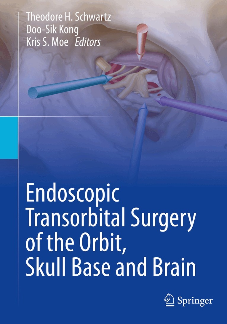 Theodore H. Schwartz, Doo-Sik Kong, Kris S. Moe - Endoscopic Transorbital Surgery of the Orbit, Skull Base and Brain, Häftad