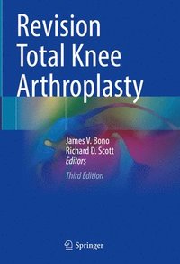 bokomslag Revision Total Knee Arthroplasty