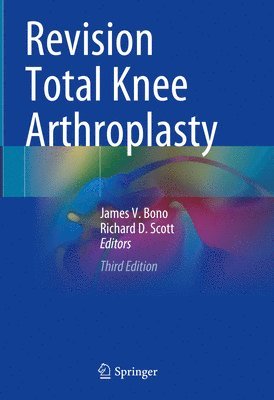 Revision Total Knee Arthroplasty 1