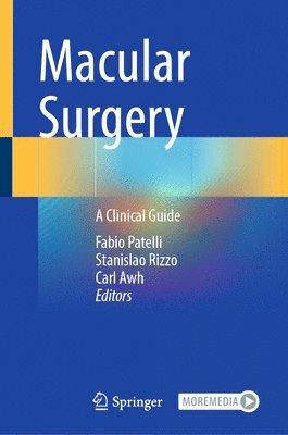 Macular Surgery 1