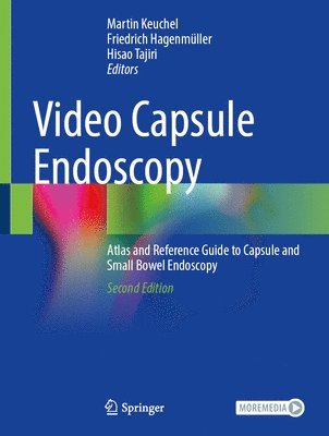 Video Capsule Endoscopy 1