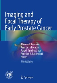 bokomslag Imaging and Focal Therapy of Early Prostate Cancer