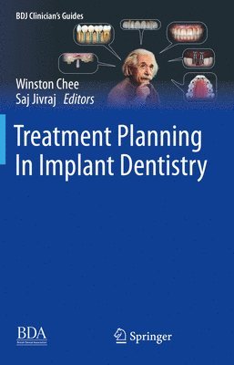 bokomslag Treatment Planning In Implant Dentistry