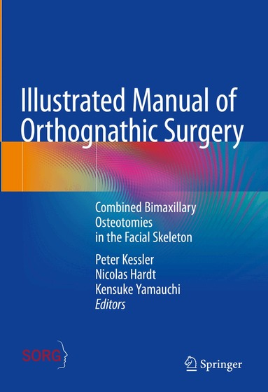 Peter Kessler, Nicolas Hardt, Kensuke Yamauchi - Illustrated Manual of Orthognathic Surgery, Inbunden