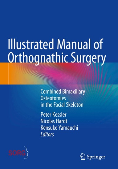 Peter Kessler, Nicolas Hardt, Kensuke Yamauchi - Illustrated Manual of Orthognathic Surgery, Häftad