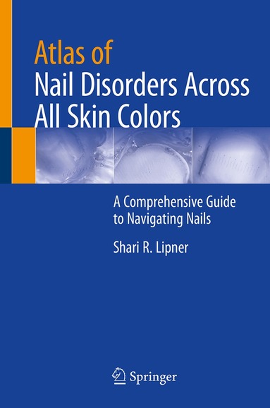 Shari R. Lipner - Atlas of Nail Disorders Across All Skin Colors, Inbunden