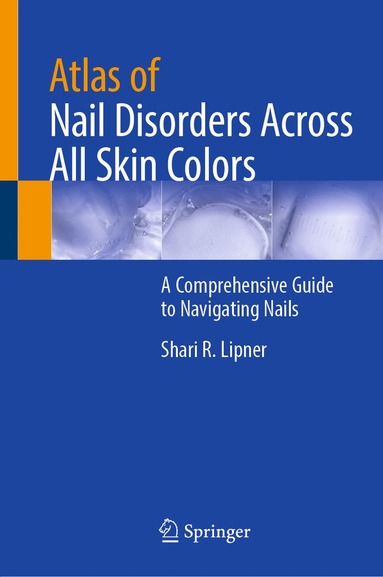 bokomslag Atlas of Nail Disorders Across All Skin Colors