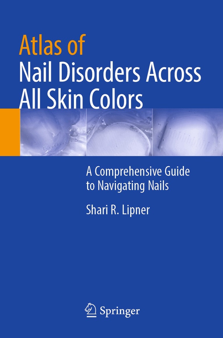 Shari R. Lipner - Atlas of Nail Disorders Across All Skin Colors, Häftad