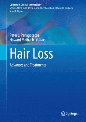 bokomslag Hair Loss