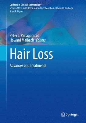 bokomslag Hair Loss