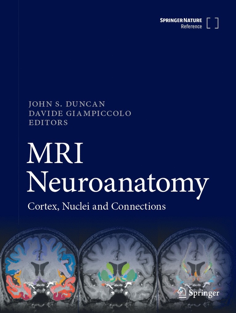 John S. Duncan, Davide Giampiccolo - MRI Neuroanatomy, Inbunden