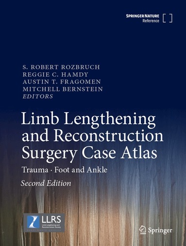 S. Robert Rozbruch, Reggie C. Hamdy, Austin T. Fragomen Jr., Mitchell Bernstein - Limb Lengthening and Reconstruction Surgery Case Atlas, Inbunden