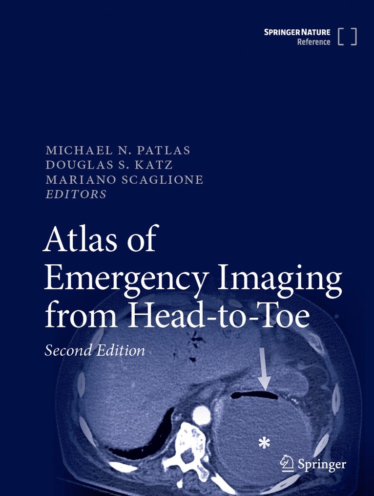 Michael N. Patlas, Douglas S. Katz, Mariano Scaglione - Atlas of Emergency Imaging from Head-to-Toe, Inbunden