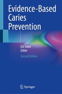 bokomslag Evidence-Based Caries Prevention