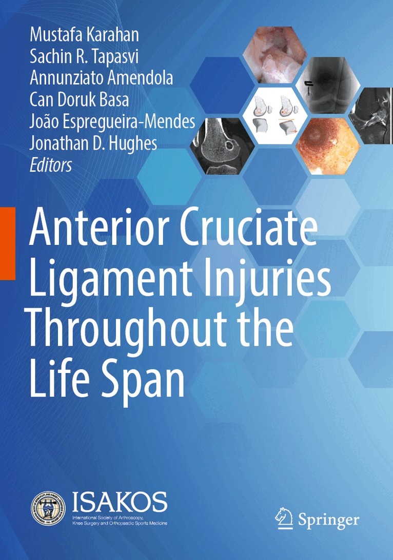 Mustafa Karahan, Sachin R. Tapasvi, Annunziato Amendola, Can Doruk Basa, João Espregueira-Mendes, Jonathan D. Hughes - Anterior Cruciate Ligament Injuries Throughout the Life Span, Häftad