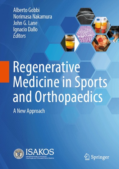 Alberto Gobbi, Norimasa Nakamura, John G. Lane, Ignacio Dallo - Regenerative Medicine in Sports and Orthopaedics, Inbunden