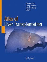 bokomslag Atlas of Liver Transplantation