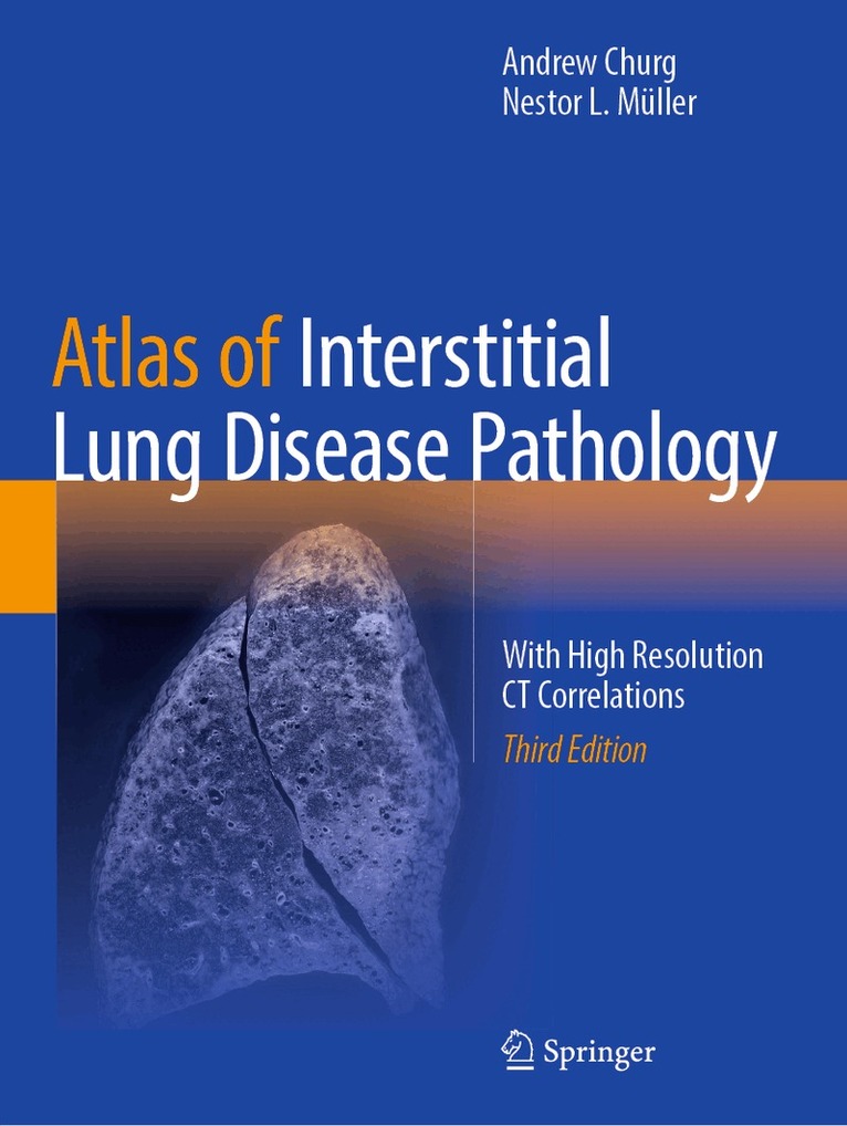 Andrew Churg, Nestor L. Müller - Atlas of Interstitial Lung Disease Pathology, Häftad