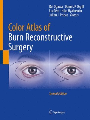 bokomslag Color Atlas of Burn Reconstructive Surgery