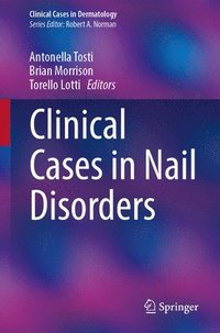 bokomslag Clinical Cases in Nail Disorders