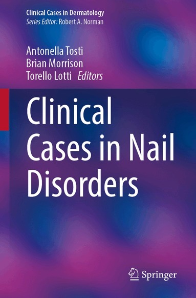 Antonella Tosti, Brian W Morrison, Torello Lotti - Clinical Cases in Nail Disorders, Häftad