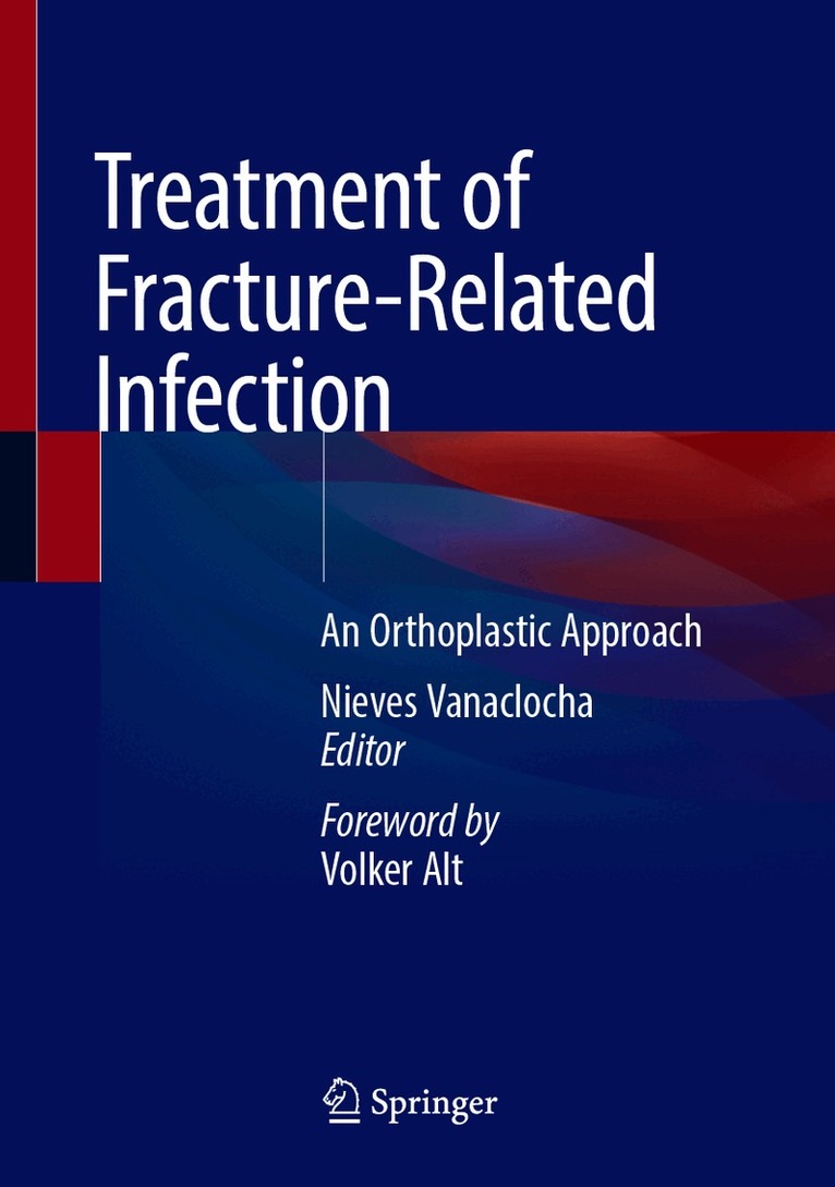 Nieves Vanaclocha - Treatment of Fracture-Related Infection, Inbunden