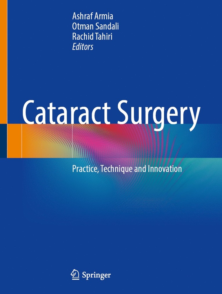 Cataract Surgery