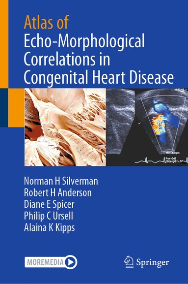 Norman H Silverman, Robert H Anderson, Diane E Spicer, Philip C Ursell, Alaina K Kipps - Atlas of Echo-Morphological Correlations in Congenital Heart Disease, Inbunden