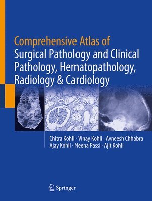 Chitra Kohli, Vinay Kohli, Avneesh Chhabra, Ajay Kohli, Neena Passi, Ajit Kohli - Comprehensive Atlas of Surgical Pathology and Clinical Pathology, Hematopathology, Radiology & Cardiology, Inbunden