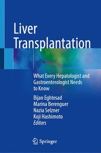 bokomslag Liver Transplantation