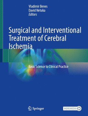 Vladimir Benes, David Netuka - Surgical and Interventional Treatment of Cerebral Ischemia, Inbunden