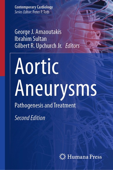 George J. Arnaoutakis, Ibrahim Sultan, Gilbert R. Upchurch Jr. - Aortic Aneurysms, Inbunden