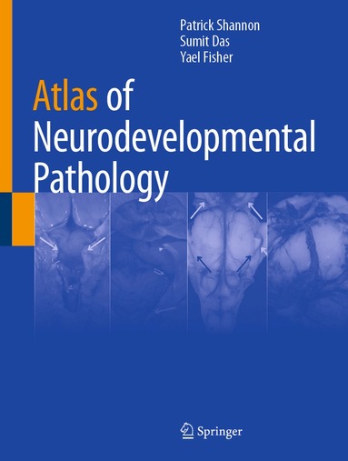 Patrick Shannon, Sumit Das, Yael Fisher - Atlas of Neurodevelopmental Pathology, Inbunden