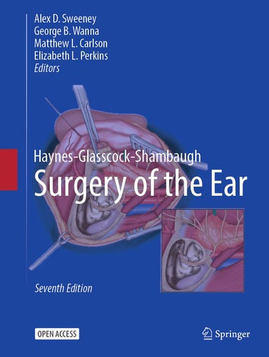 Alex D. Sweeney, George B. Wanna, Matthew L. Carlson, Elizabeth L. Perkins - Haynes-Glasscock-Shambaugh Surgery of the Ear, Inbunden