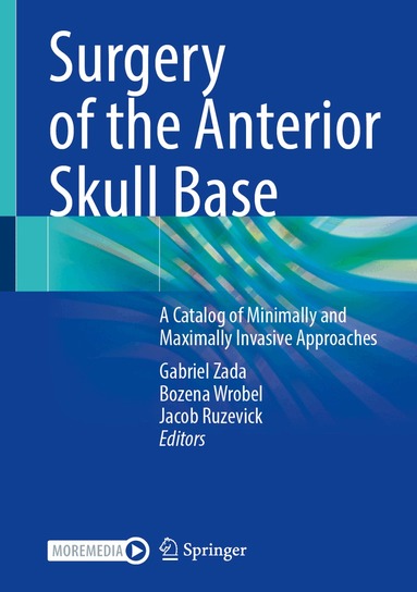 Gabriel Zada, Bozena Wrobel, Jacob Ruzevick - Surgery of the Anterior Skull Base, Inbunden