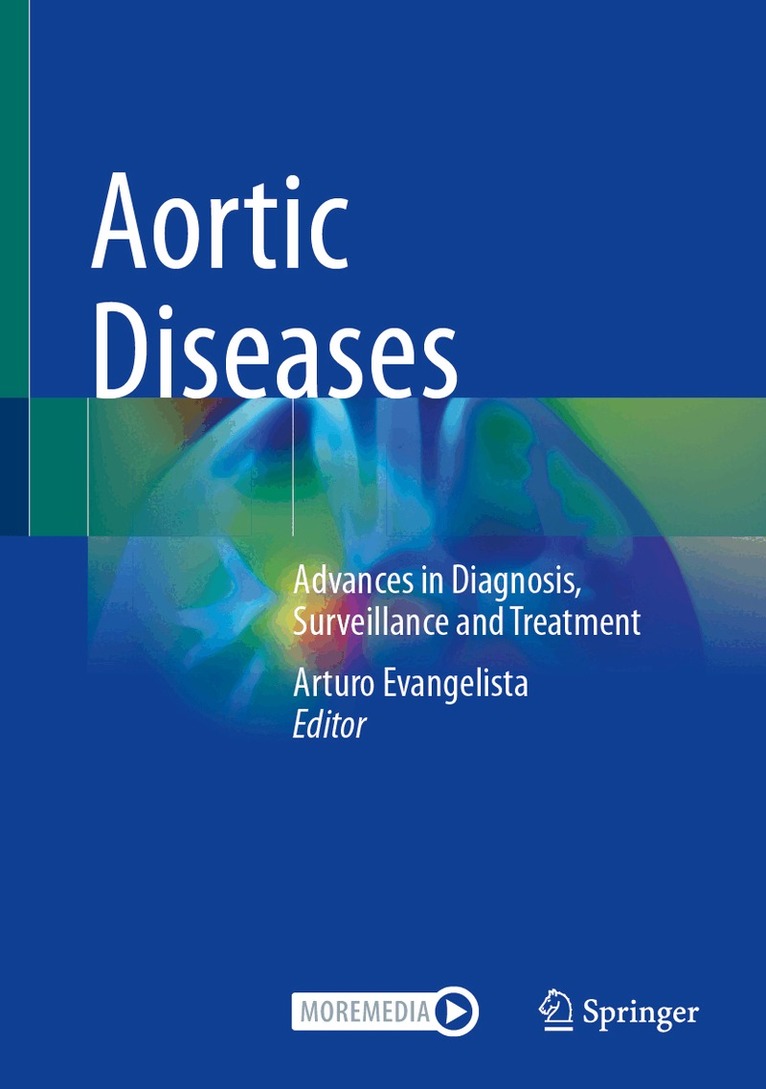 Arturo Evangelista - Aortic Diseases, Inbunden. Tillgänglighet: Lägg i varukorg