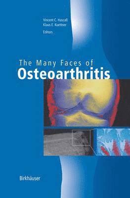 The Many Faces of Osteoarthritis 1