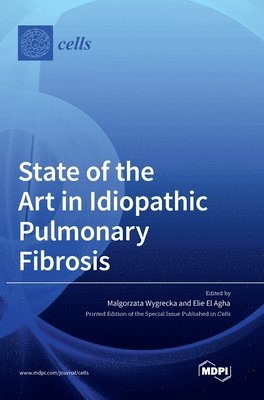 bokomslag State of the Art in Idiopathic Pulmonary Fibrosis