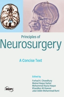 bokomslag Principles of Neurosurgery