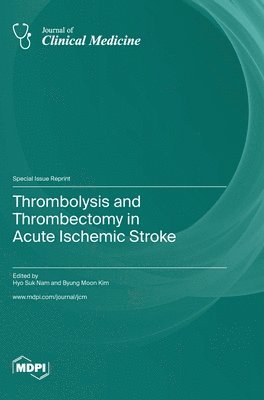 Thrombolysis and Thrombectomy in Acute Ischemic Stroke 1