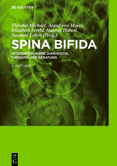 Theodor Michael, Arpad Moers, Elisabeth Strehl, Hannes Haberl, Susanne Lebek - Spina bifida, Inbunden