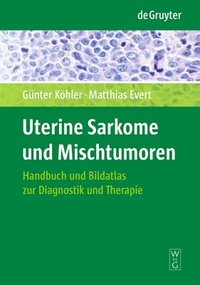 bokomslag Uterine Sarkome und Mischtumoren