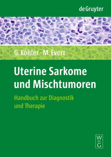 bokomslag Uterine Sarkome und Mischtumoren