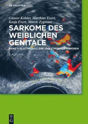 Günter Köhler, Matthias Evert, Katja Evert, Marek Zygmunt - Glattmuskuläre und stromale Tumoren, Inbunden. Tillgänglighet: Tillfälligt slut