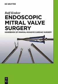 bokomslag Endoscopic Mitral Valve Surgery