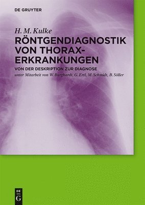 bokomslag Röntgendiagnostik von Thoraxerkrankungen