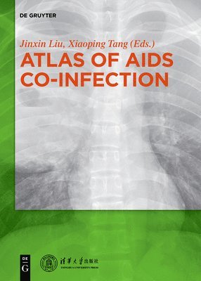 Liu Jinxin, Tang Xiaoping - Atlas of AIDS Co-infection, Inbunden