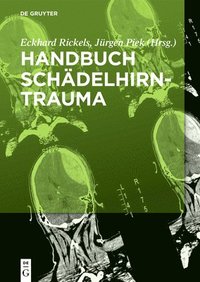 bokomslag Handbuch Schdelhirntrauma